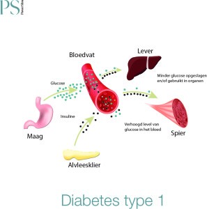 Diabetes-Type-1--297x300